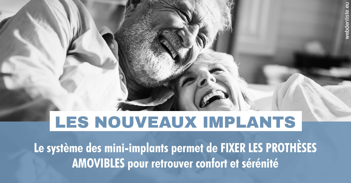 https://dr-juzan-cecile.chirurgiens-dentistes.fr/Les nouveaux implants 2