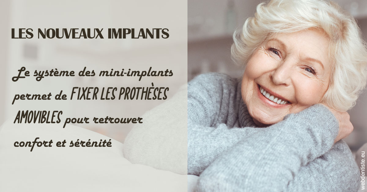 https://dr-juzan-cecile.chirurgiens-dentistes.fr/Les nouveaux implants 1