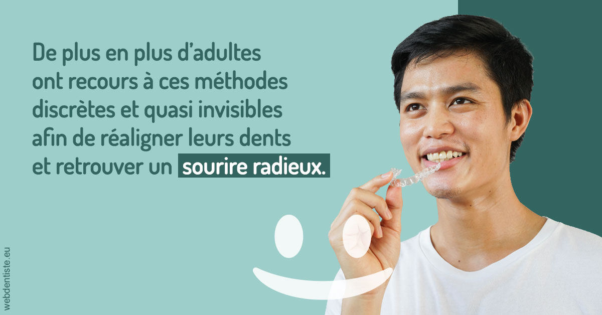 https://dr-juzan-cecile.chirurgiens-dentistes.fr/Gouttières sourire radieux 2