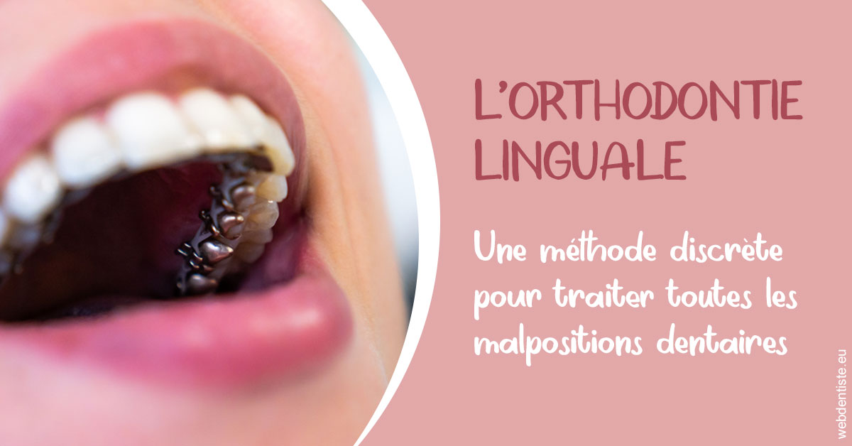 https://dr-juzan-cecile.chirurgiens-dentistes.fr/L'orthodontie linguale 2