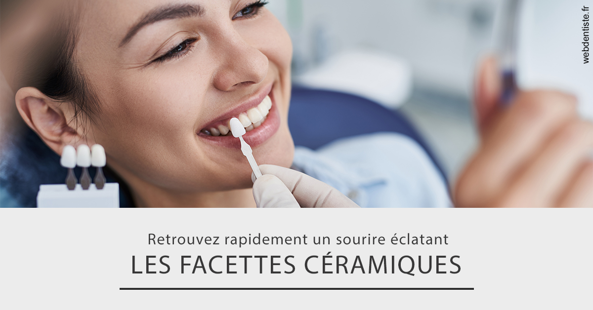 https://dr-juzan-cecile.chirurgiens-dentistes.fr/Les facettes céramiques 2