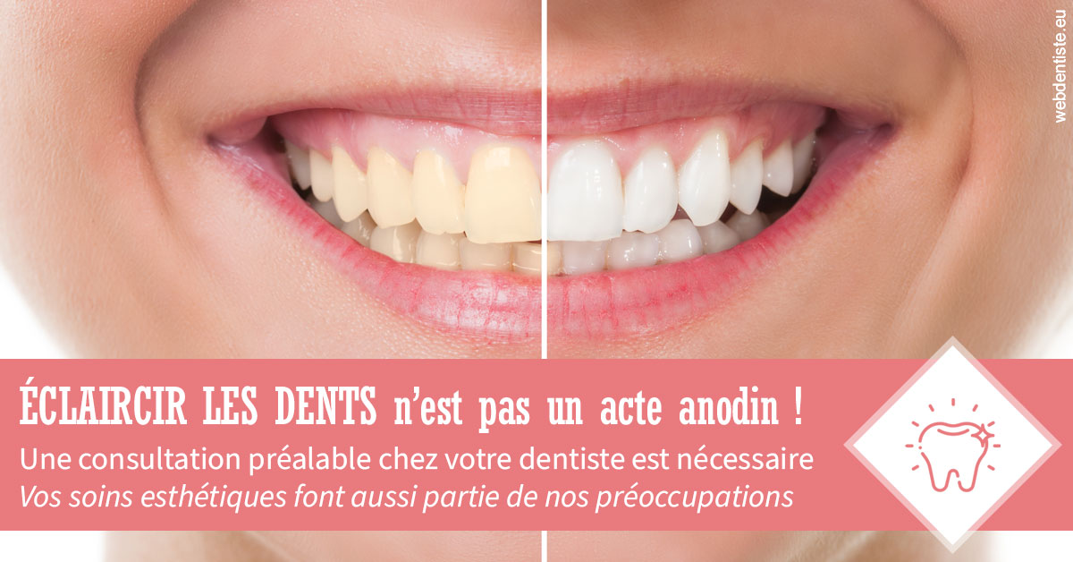 https://dr-juzan-cecile.chirurgiens-dentistes.fr/Eclaircir les dents 1