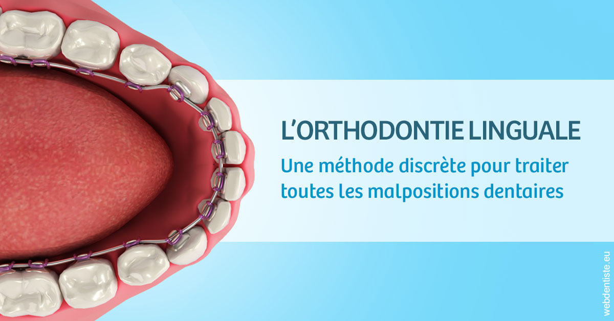 https://dr-juzan-cecile.chirurgiens-dentistes.fr/L'orthodontie linguale 1