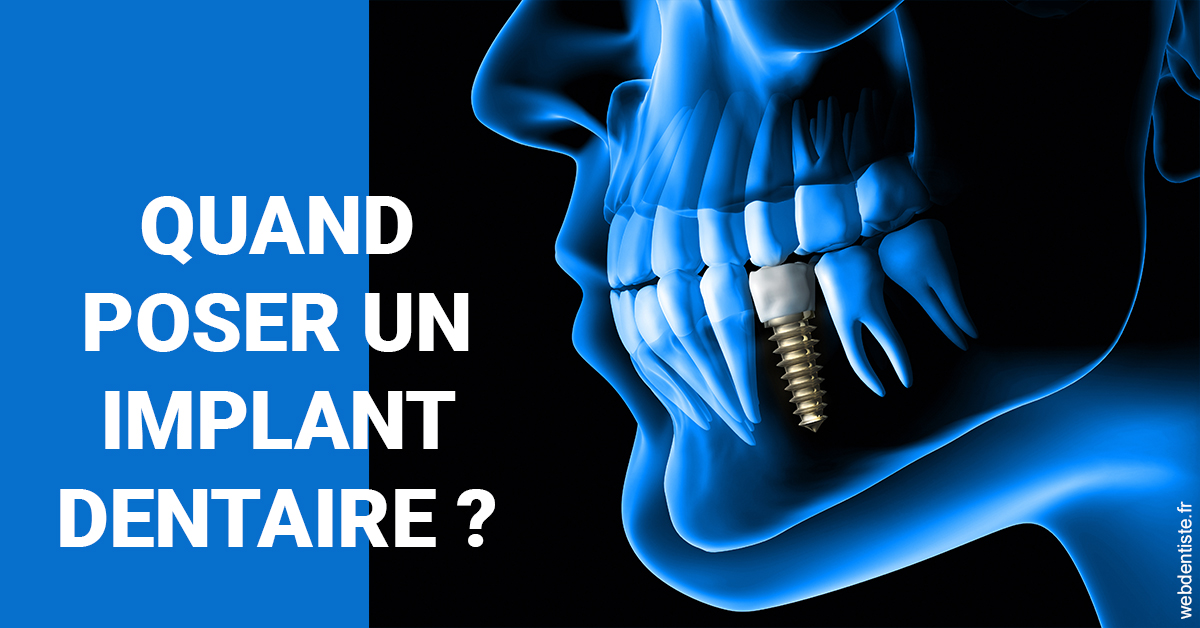 https://dr-juzan-cecile.chirurgiens-dentistes.fr/Les implants 1
