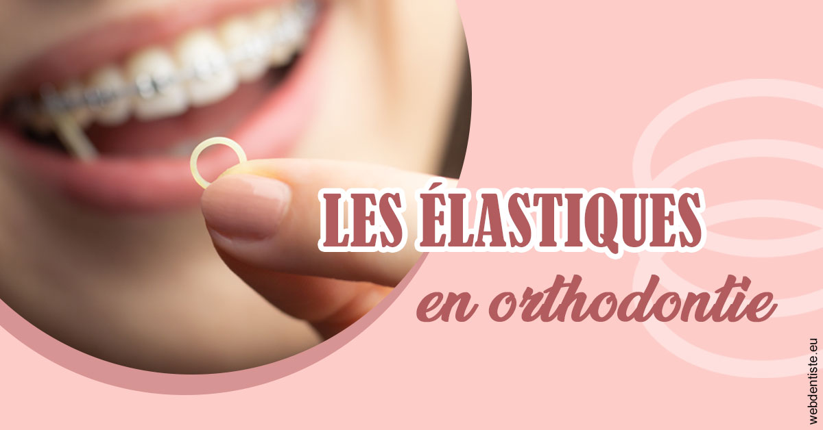 https://dr-juzan-cecile.chirurgiens-dentistes.fr/Elastiques orthodontie 1