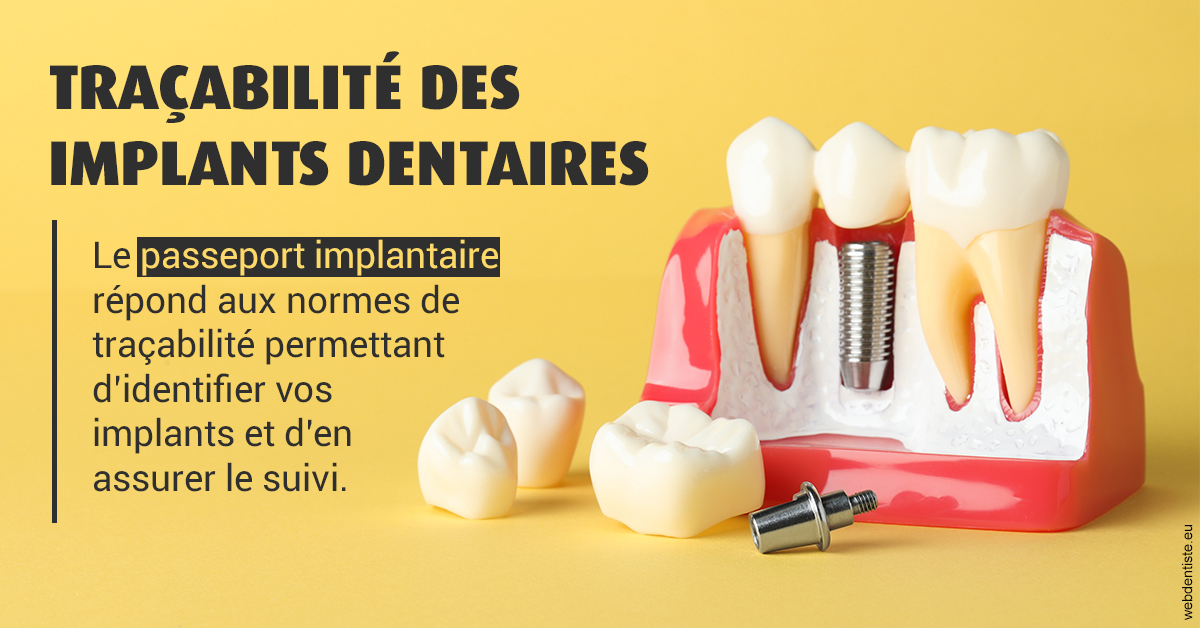 https://dr-juzan-cecile.chirurgiens-dentistes.fr/T2 2023 - Traçabilité des implants 2
