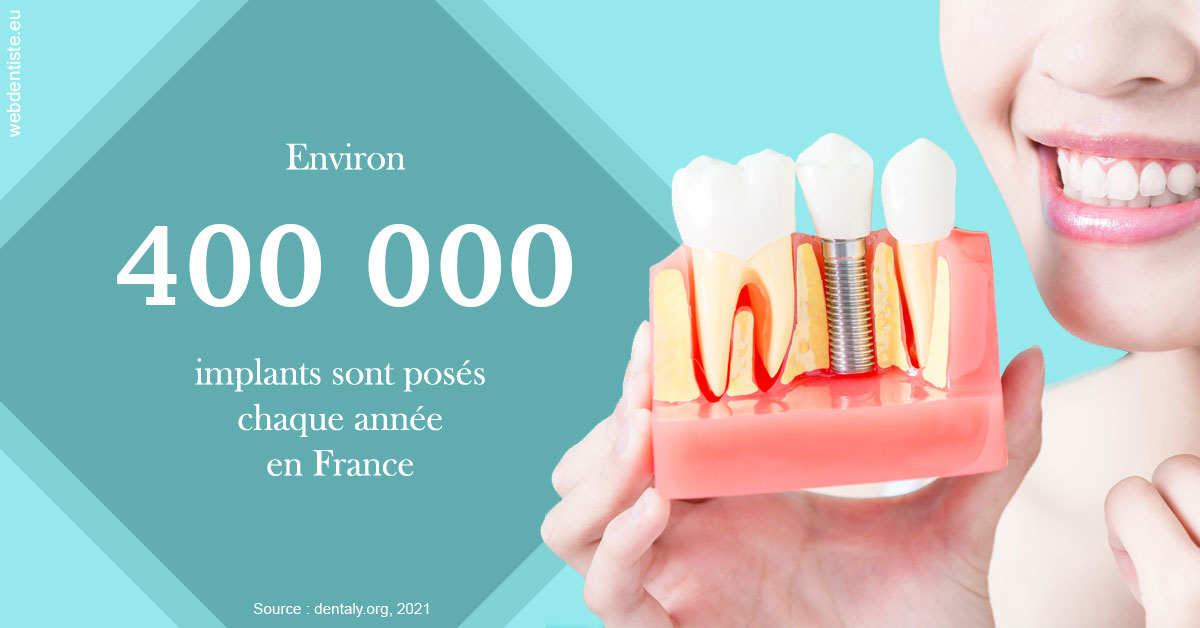 https://dr-juzan-cecile.chirurgiens-dentistes.fr/Pose d'implants en France 2