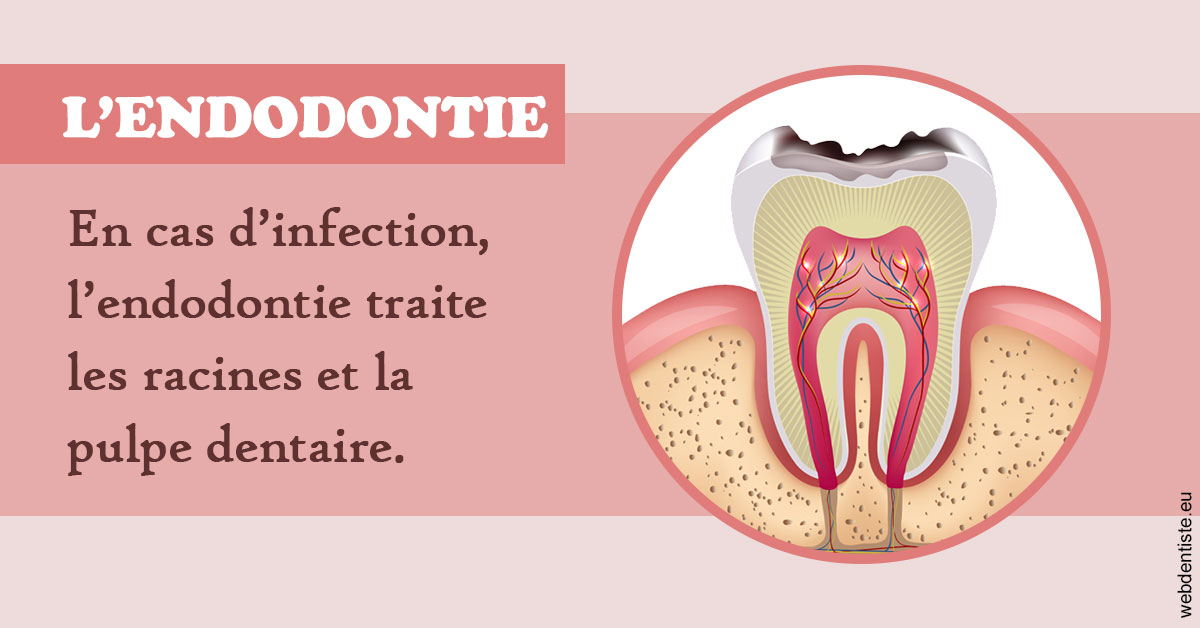 https://dr-juzan-cecile.chirurgiens-dentistes.fr/L'endodontie 2